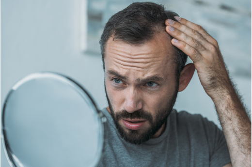 Hair Loss Treatments